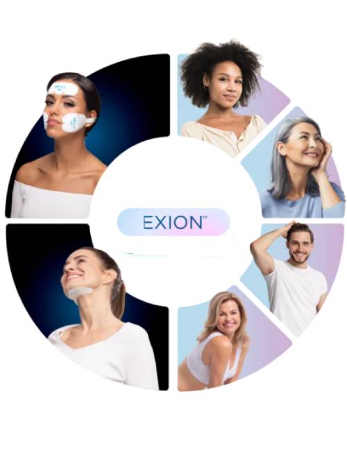 Exion